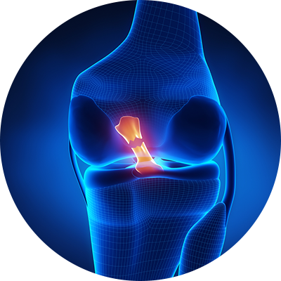 ico-lesoesligamentares