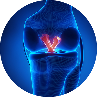 ico-reconstrucaoligamentar