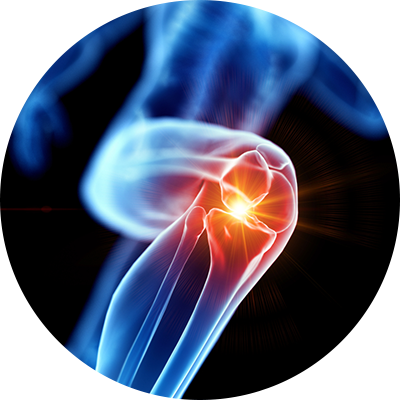 ico-traumatologiaesportiva